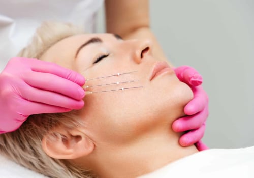 The Revolutionary PDO Thread Lift: What You Need to Know